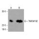 TMEM192 Antibody (F-12) - Western Blotting - Image 416489