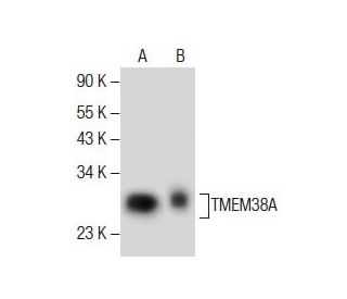 TMEM38A Antibody (G-12) - Western Blotting - Image 285421 