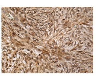 TMEM43 Antibody (E-1) - Immunohistochemistry - Image 161019 