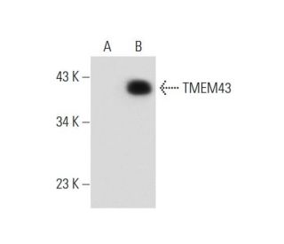 TMEM43 Antibody (F-3) - Western Blotting - Image 137695