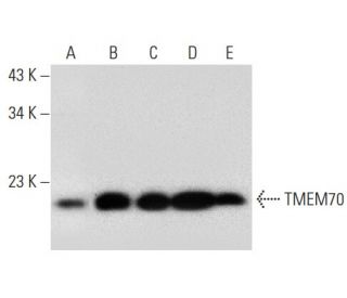 TMEM70 Antibody (B-6) - Western Blotting - Image 296935 