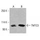 Anticorpo TMTC3 (G-9): sc-398137. Analisi Western blot dell'espressione di TMTC3 nei lisati cellulari totali di K-562 (A) e HCT-116 (B). Reagente di rilevamento utilizzato: m-IgG Fc BP-HRP: sc-525409. TMTC3 Antibody (G-9) - Western Blotting - Image 415374
