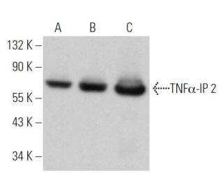 TNF&alpha;-IP 2 Antibody (C-6) - Western Blotting - Image 363630Each CRISPR/Cas9 Knockout (KO) Plasmid product consists of a pool of 3 plasmids designed to ensure identification and cleavage of a specific gene for maximum knockout efficiency. Each plasmid encodes a unique 20 nt sequence derived from the GeCKO (v2) library. 