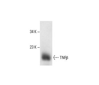 TNF&beta; Antibody (359-81-11) - Western Blotting - Image 11641