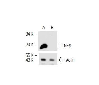 TNF&beta; shRNA Plasmid (h): sc-37218-SH. Western blot analysis of human TNF&beta; expression in TNF&beta; transfected (A) 