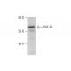 TNF-R1 Antibody (H398) - Western Blotting - Image 59812