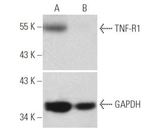 TNF-R1 siRNA (h): sc-29507. Western blot analysis of TNF-R1 expression in non-transfected control (A) and TNF-R1 siRNA tra 