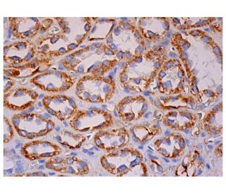 TNF-R2 Antibody (D-2) - Immunohistochemistry - Image 284907 