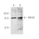 TNF-R2 Antibody (D-2) - Western Blotting - Image 2856 