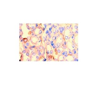 TNF-R2 Antibody (TR75-32) - Immunohistochemistry - Image 2867