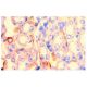 TNF-R2 Antibody (TR75-32) - Immunohistochemistry - Image 2867