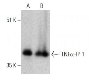 TNF&alpha;-IP 1 Antibody (F-4) - Western Blotting - Image 363289