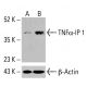 TNFα-IP 1 抗體 (F-4):sc-515765。Western blot分析未處理(A)與化學處理(B)HeLa全細胞裂解液中TNFα-IP 1之表現。β-肌動蛋白(C4):sc-47778用作載量對照。檢測試劑:m-IgG Fc BP-HRP:sc-525409。 TNFα-IP 1 Antibody (F-4) - Western Blotting - Image 416100