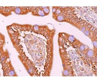 TNIK Antibody (C-1) - Immunohistochemistry - Image 370322 