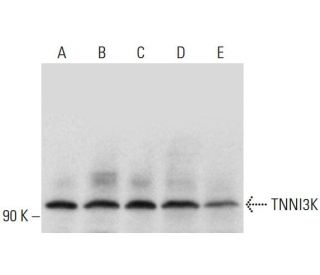 TNNI3K Antibody (H-7) - Western Blotting - Image 320453 