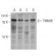 TNNI3K Antibody (H-7) - Western Blotting - Image 400669