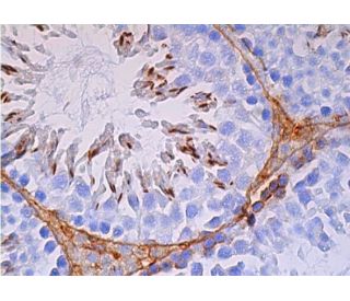 TNP2 Antibody (B-2) - Immunohistochemistry - Image 386564 