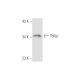 Tollip Antibody (Kimmy-2) - Western Blotting - Image 56377 