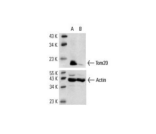 Tom20 siRNA (h): sc-36691. Western blot analysis of Tom20 expression in non-transfected control (A) and Tom20 siRNA transf 