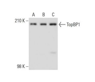 TopBP1 Antibody (B-7) - Western Blotting - Image 134903 
