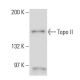 Topo II Antibody (T22C5) - Western Blotting - Image 16456