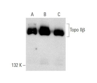 Topo II&beta; Antibody (B-6) - Western Blotting - Image 145575 