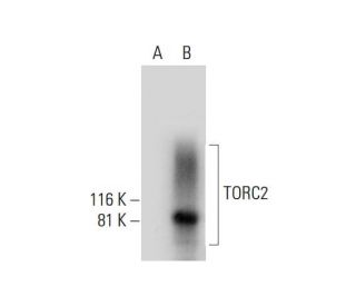 TORC2 Antibody (D-2) - Western Blotting - Image 289995