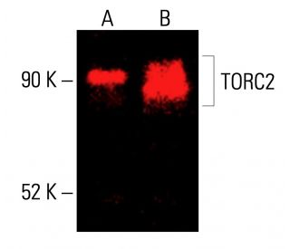 TORC2 Antibody (F-4) - Western Blotting - Image 416179 