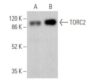 TORC2 Antibody (G-4) - Western Blotting - Image 362220
