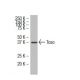 Toso Antibody (RR-16) - Western Blotting - Image 34612