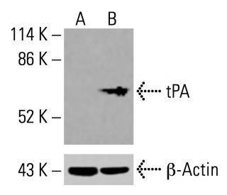 tPA Antibody (D-1) - Western Blotting - Image 416039