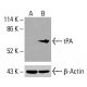 Hec1 抗体 (C-11):sc-515550。通过 Western blot 分析 K-562 (A) 和 HCT-116 (B) 细胞裂解物中 Hec1 的表达。使用的检测试剂:m-IgG2b BP-HRP:sc-542741。 tPA Antibody (D-1) - Western Blotting - Image 416039