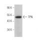 TPN Antibody (B-9) - Western Blotting - Image 365919