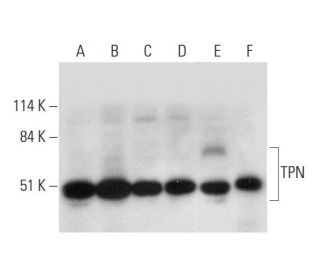 TPN Antibody (F-6) - Western Blotting - Image 333380 