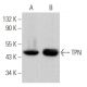 TPN Antibody (F-6) - Western Blotting - Image 369896