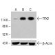 TPX2 Antibody (B-10) - Western Blotting - Image 415022