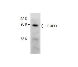 TRABID Antibody (F-1) - Western Blotting - Image 150221SAM Transcription Activation: SAM system utilizing dCas9-VP64, MS2-P65-HSF1, and sgRNA for precise gene transcription activation.