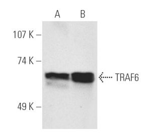 TRAF6 Antibody (D-10) - Western Blotting - Image 3228SAM Transcription Activation: SAM system utilizing dCas9-VP64, MS2-P65-HSF1, and sgRNA for precise gene transcription activation.