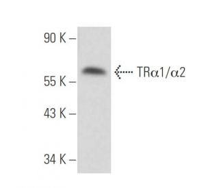 TR&alpha;1/&alpha;2 Antibody (2103) - Western Blotting - Image 17181