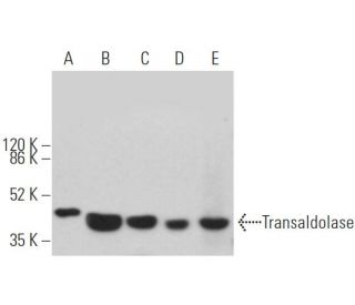 Transaldolase Antibody (H-4) - Western Blotting - Image 362432 