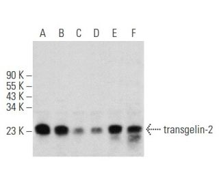 transgelin-2 Antibody (D-8) - Western Blotting - Image 357004 