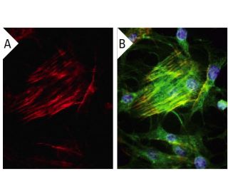 transgelin Antibody (1B8) - Immunofluorescence - Image 15150