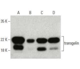 transgelin Antibody (6G6) - Western Blotting - Image 396690 