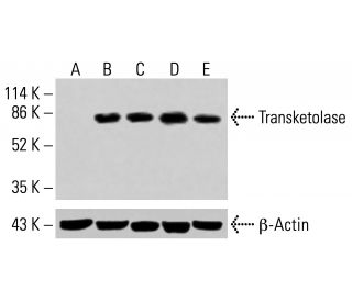 Transketolase Antibody (H-7) - Western Blotting - Image 415021