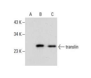 translin Antibody (C-2) - Western Blotting - Image 288613Each CRISPR/Cas9 Knockout (KO) Plasmid product consists of a pool of 3 plasmids designed to ensure identification and cleavage of a specific gene for maximum knockout efficiency. Each plasmid encodes a unique 20 nt sequence derived from the GeCKO (v2) library. 