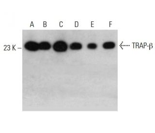 TRAP-&beta; Antibody (AT31G6) - Western Blotting - Image 385121 