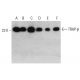 TRAP-β Antibody (AT31G6) - Western Blotting - Image 385121 