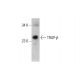 TRAP-β Antibody (AT31G6) - Western Blotting - Image 385122