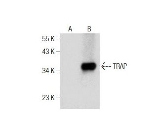 TRAP Antibody (D-3) - Western Blotting - Image 160873Each CRISPR/Cas9 Knockout (KO) Plasmid product consists of a pool of 3 plasmids designed to ensure identification and cleavage of a specific gene for maximum knockout efficiency. Each plasmid encodes a unique 20 nt sequence derived from the GeCKO (v2) library.