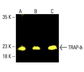TRAP-&delta; Antibody (C-6) - Western Blotting - Image 412941 